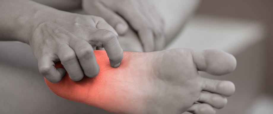 Diabetes and feet – Plantar warts symptoms